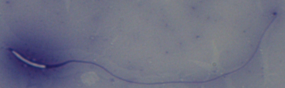 Milky Stork Sperm Milky Stork Sperm